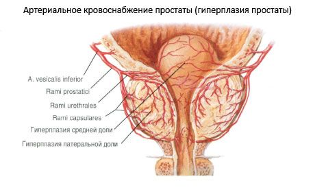 Prostata (prostatakörtel)