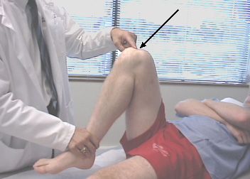 Smärta i knä under flexion är den vanligaste anledningen till att människor besöker traumaläkare. 