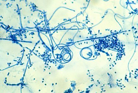 Den orsakande agenten av fötternas epidermofytos (Trichophyton interdigitale)